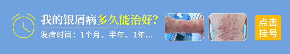 长沙博润银屑病医院