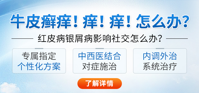 长沙博润银屑病医院
